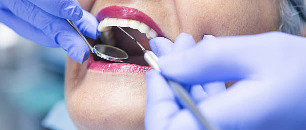 Best Emergency Dental Filling Replacement  in New Lebanon, OH